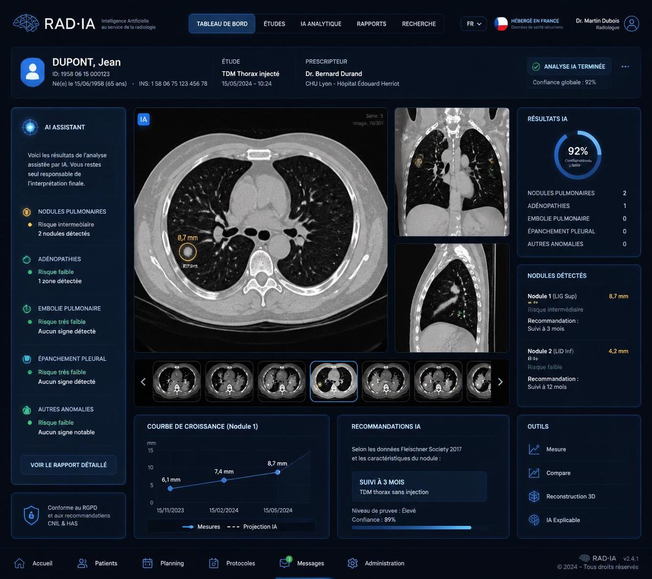 découvrez tout sur les sociétés françaises de radiologie, leurs avancées technologiques et innovations médicales qui transforment le secteur.